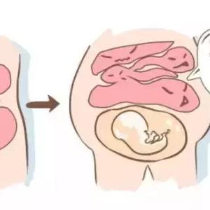 (hcg值多少可以确定怀孕)HCG水平多少可以肯定确认怀孕？